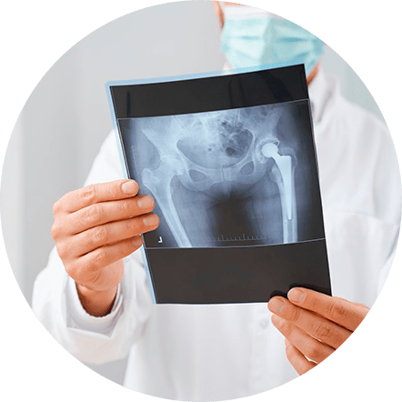 Cirurgia do Quadril